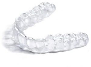 Gouttières d'orthodontie : conseils, entretien